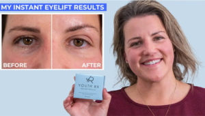 YouthRx Instant eyelift