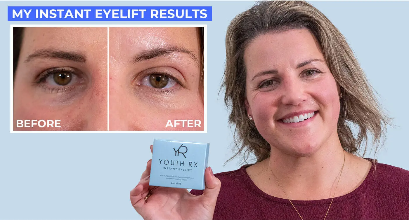 YouthRx Instant eyelift